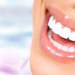 Cosmetic Dentistry in Vancouver