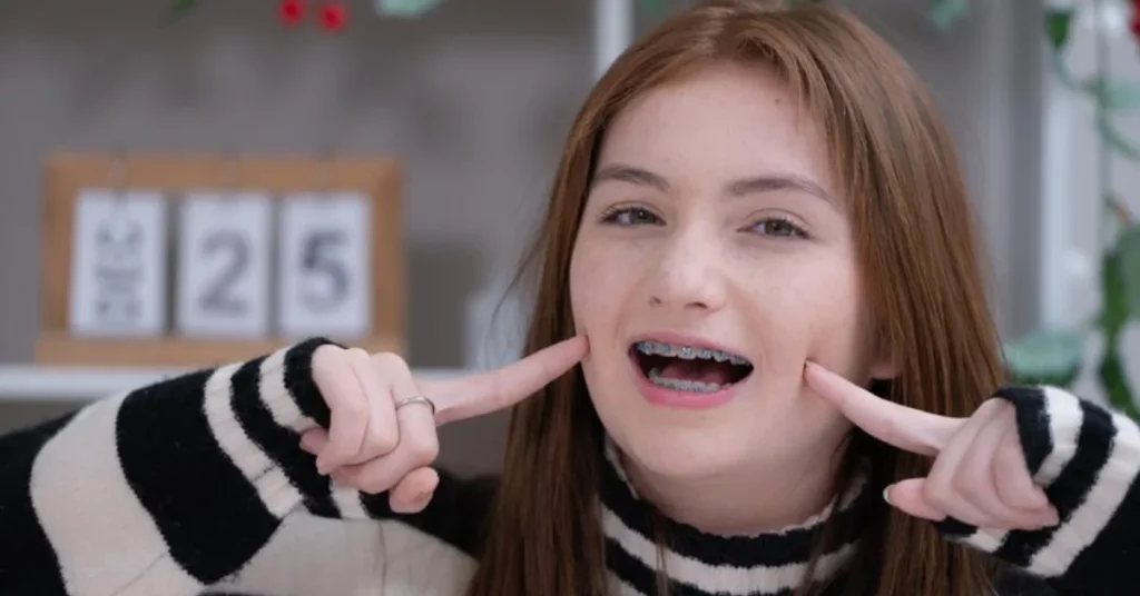 Teeth Braces for Adults