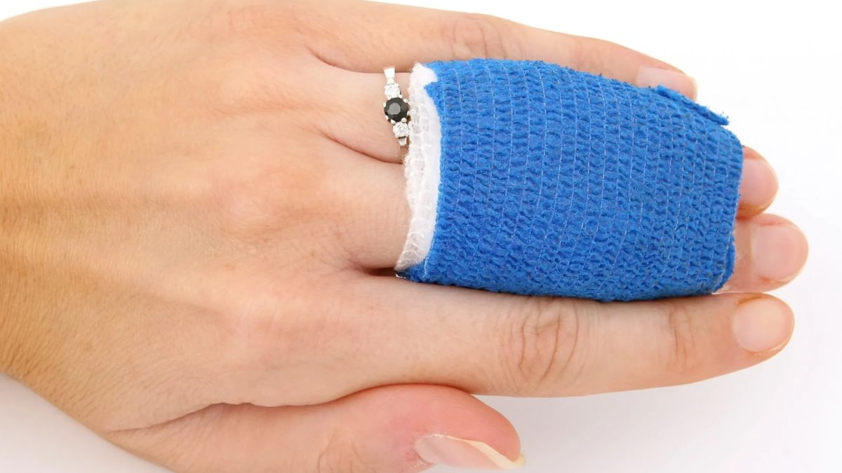 Severe Burn Injury