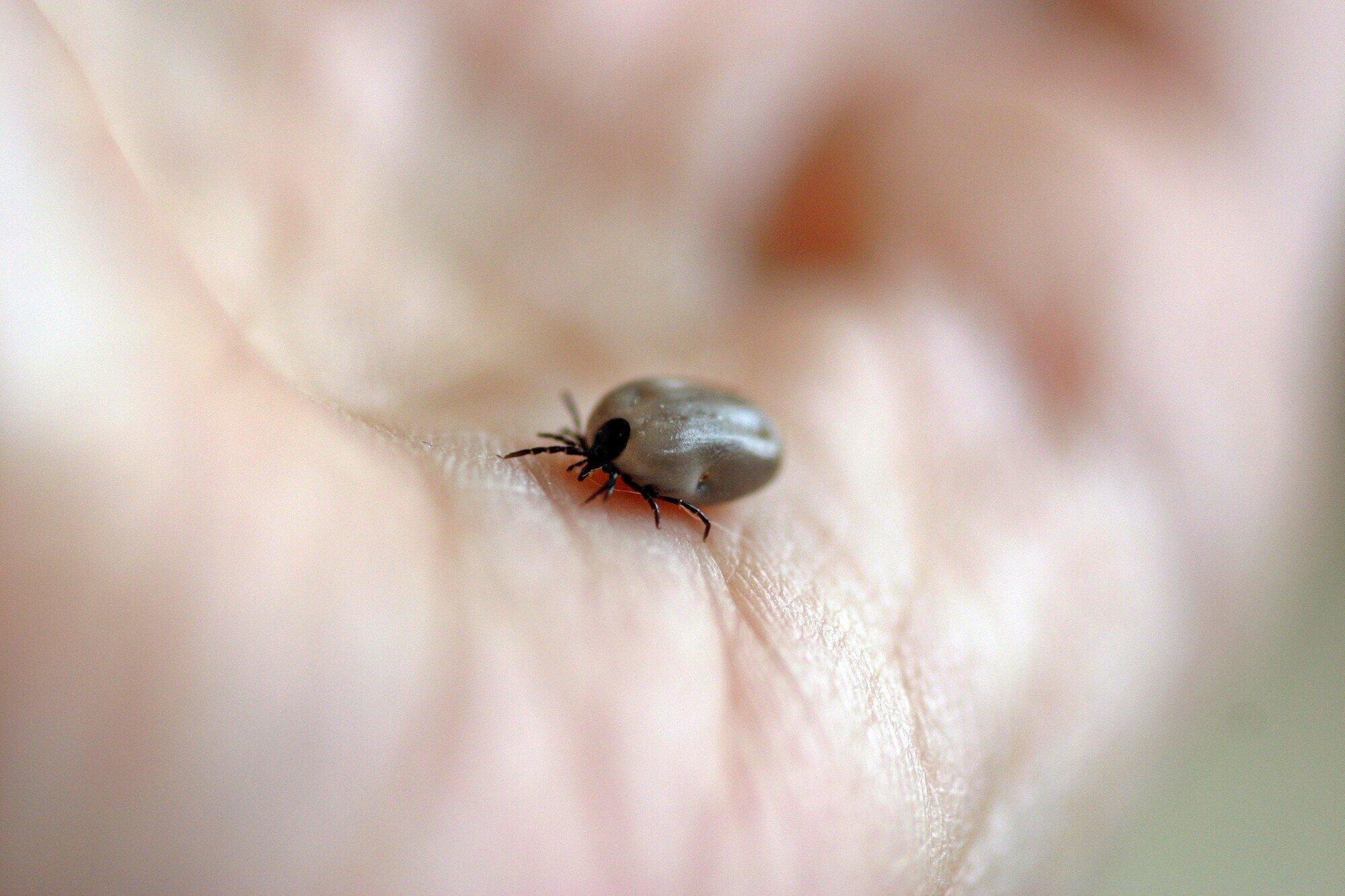 Tick-Free Adventure
