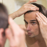 FUE Hair Transplants