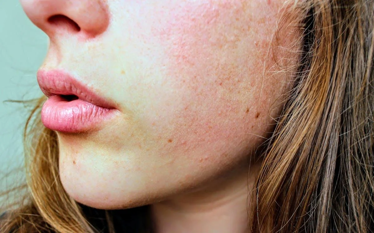 Healthy Skin