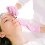 Dermal Fillers