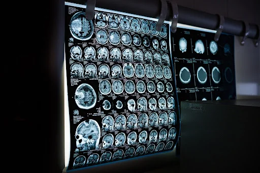 X-Rays