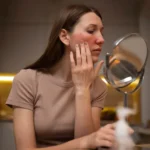 Skin Conditions