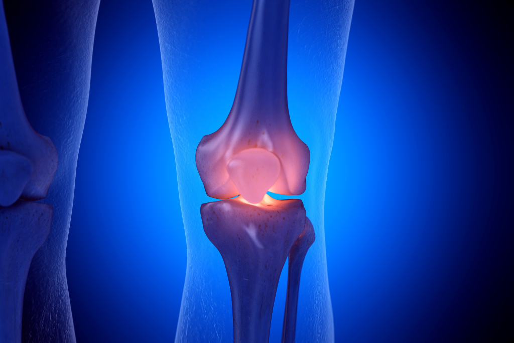 3d-render-of-human-knee-joint-highlighting-patella-and-ligaments-during-knee-support-assessment