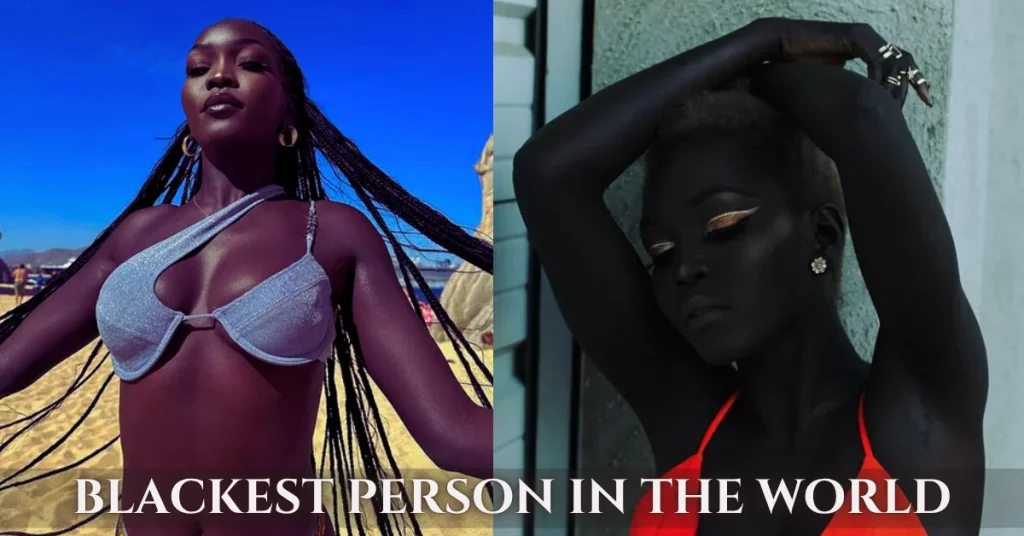 blackest person in the world