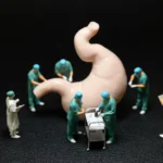 Bariatric Surgery