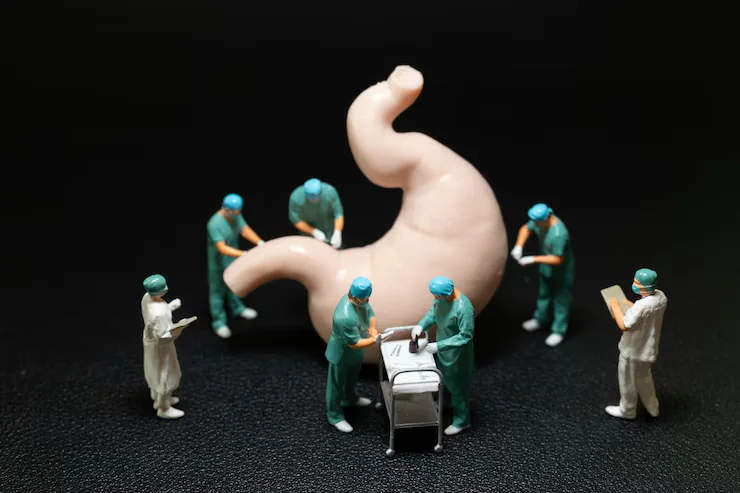 Bariatric Surgery