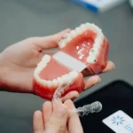 Invisalign