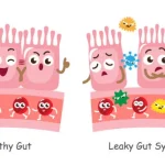 Gut-Skin