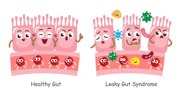 Gut-Skin