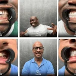 Hollywood Smile