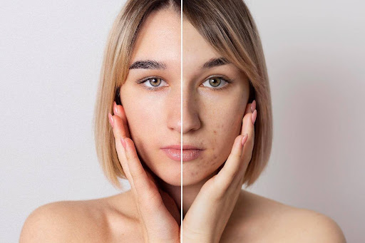 Signs of Skin Damage