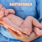 Gastroshiza