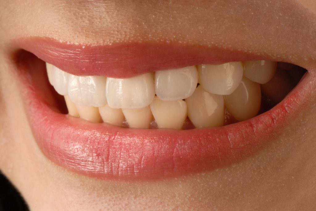 Aesthetic Dentistry