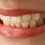 Aesthetic Dentistry