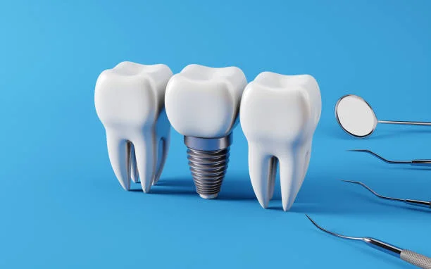 Dental implants