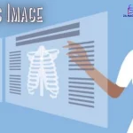 Diag Image