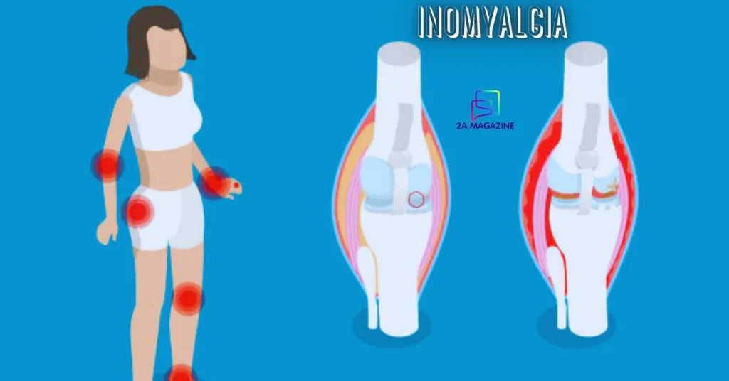 inomyalgia