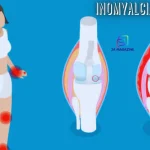 inomyalgia