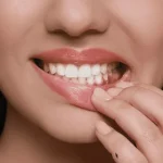 Castor Oil for Oral Health