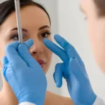 Liposuction in Toronto