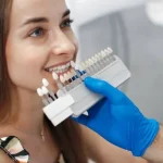 Dental Veneers