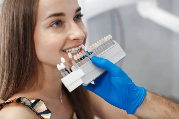 Dental Veneers