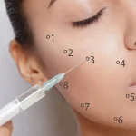 Dermal Fillers in Dubai