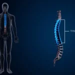 Spinal-Cord Injuries