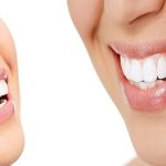 Enhance Your Smile: Expert Tips on Dental Treatments That Work