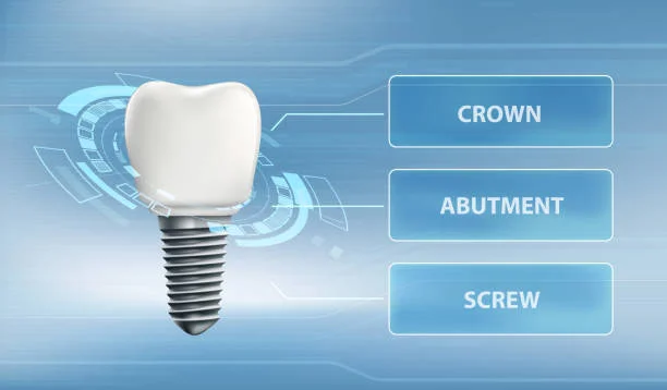 Dental Implants in Arlington