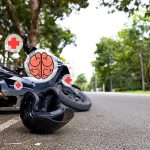 Motorcycle Accidents