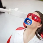 professional teeth whitening