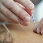 How Acupuncture Complements Modern Lifestyle Practices