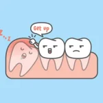 wisdom tooth extraction