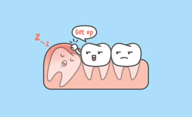 wisdom tooth extraction