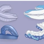 Anti-Snoring Devices