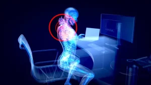 Poor workplace ergonomics