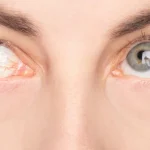 Eye Conditions That Affect Central Vision After 50