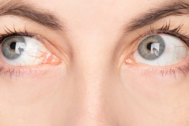 Eye Conditions That Affect Central Vision After 50