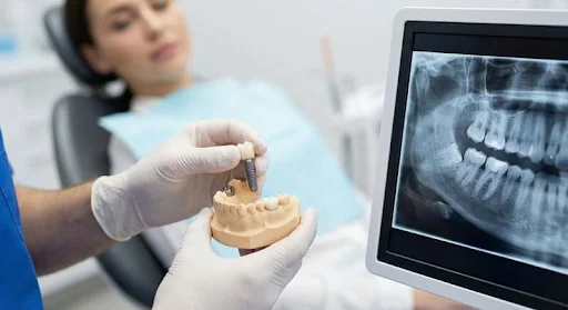 Dental Implants Safety