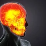 Hypoxic and Anoxic Brain Injuries