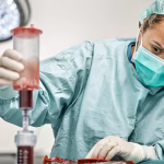 STEM CELL Recovery and Follow-up: What Patients Should Expect After Treatment