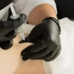 Bursa vs Tendon Injection