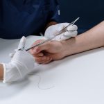 Advanced Negative Pressure Therapy in Wound Care