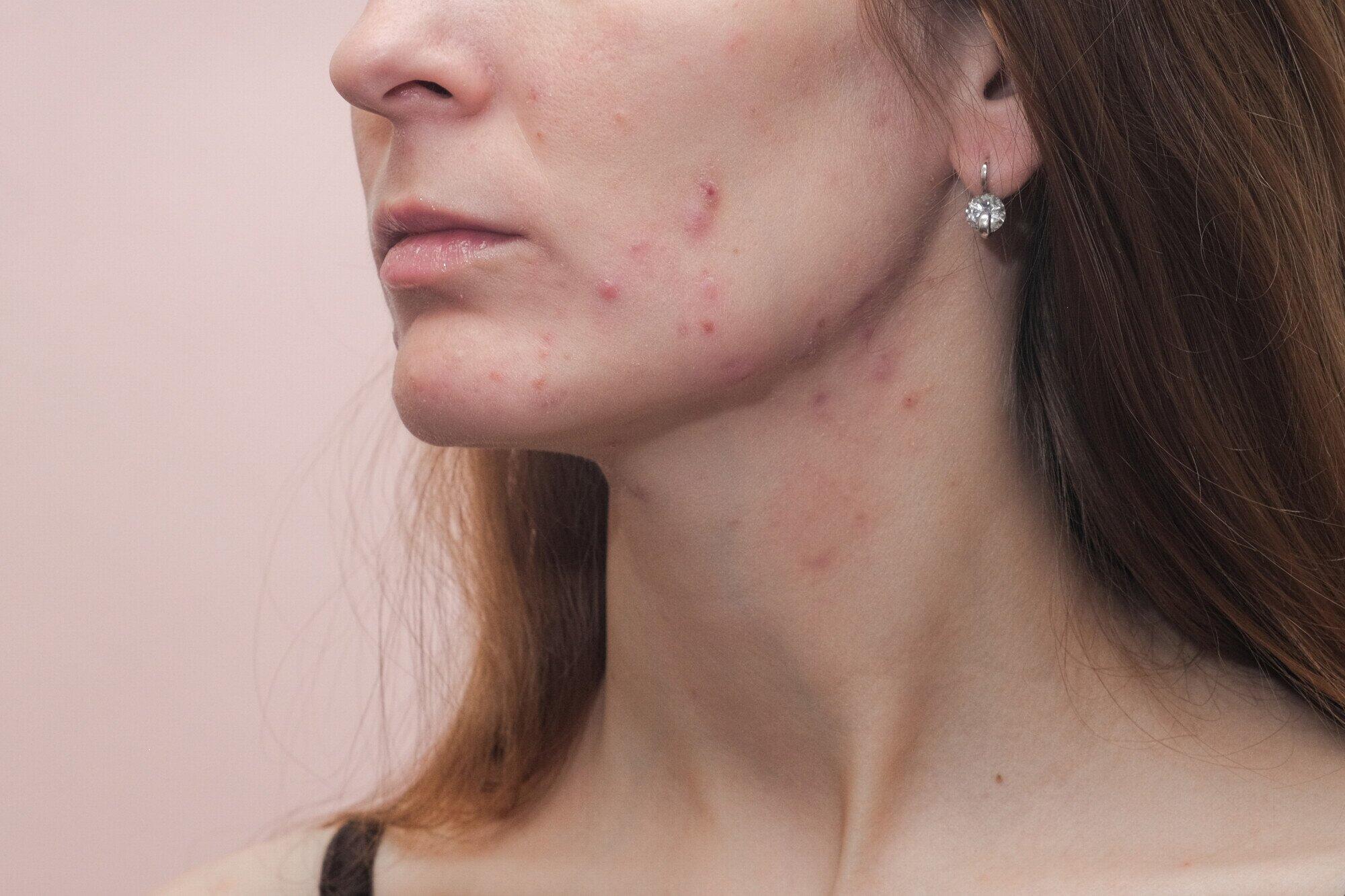 Specialized Care for Joint and Autoimmune Conditions