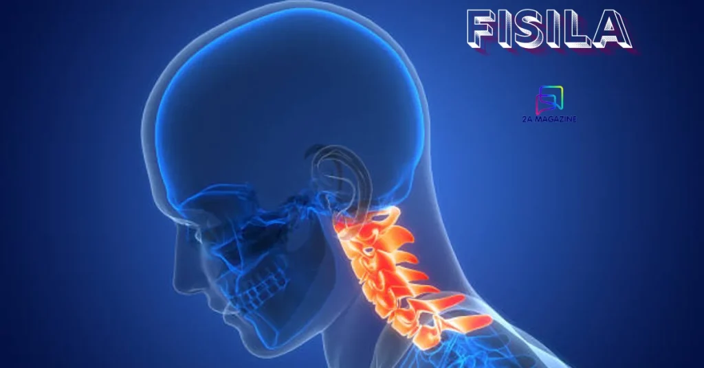 Medical illustration showing abnormal fistula passage between two body organs — fisila explained