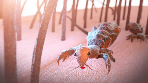 lice treatment Savannah GA